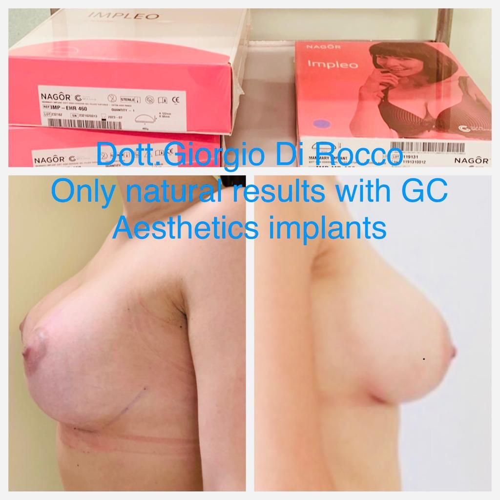 GC_impianti_estetici